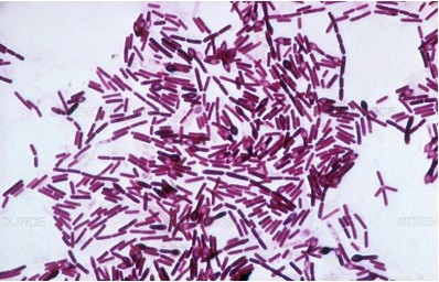 Vi khuẩn Clostridium botilinum và vấn đề ngộ độc thực phẩm
